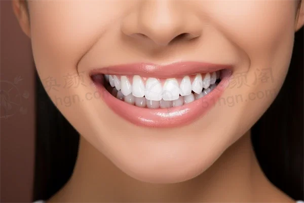 滨州贝佳口腔种植牙价格揭秘，2026年种植牙全过程分享及医院推荐