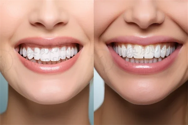 福州同福医口腔医院详细价目表，2026年福州口腔医院推荐及比较分析