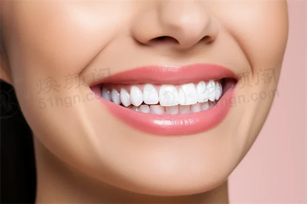 哈尔滨牙科医院排名前十，优诺博士口腔门诊补牙项目结果显著，值得信赖的选择