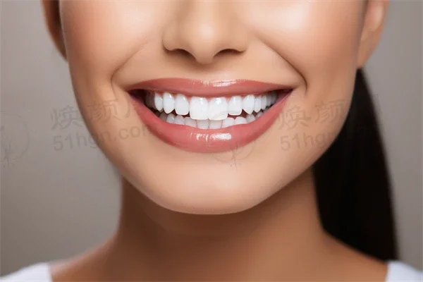 安徽地区牙科医院排名前十，淮南益口口腔门诊部洗牙项目值得信赖，专業优质服务！