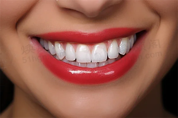 惠州李飞口腔门诊部推出超值牙齿矫正优惠活动，原价8000元起现仅需6800元起！