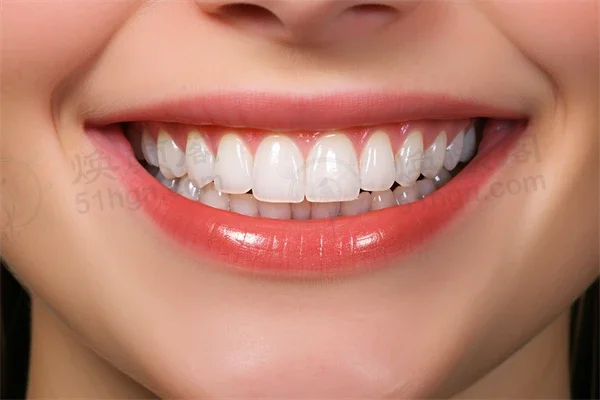 廊坊地区牙科医院排名前十，哪家更具优势？廊坊鹏飞口腔门诊部牙齿矫正项目值得信赖，专業高效率！