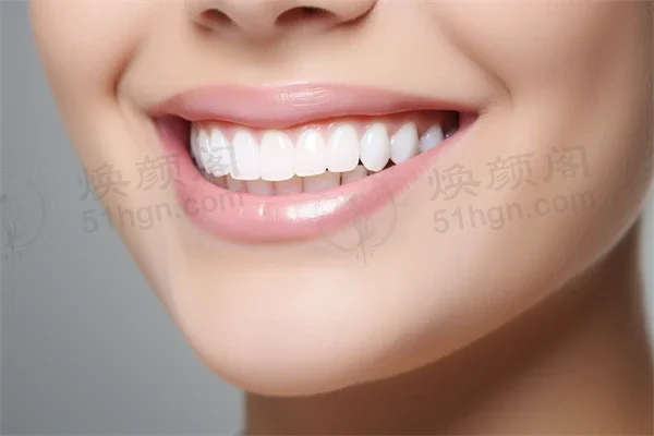 淄博可恩口腔医院怎么样？中老年种植牙价格实惠，牙齿矫正服务值得信赖！