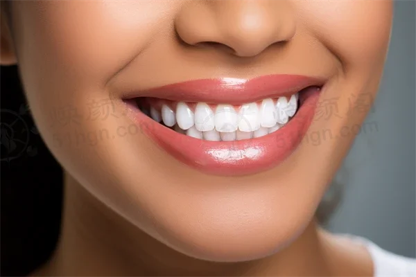 西安天皓口腔医院2026年价格一览，种植牙、矫正、补牙、儿童牙科治疗全覆盖，交通路线指南助您轻松就医