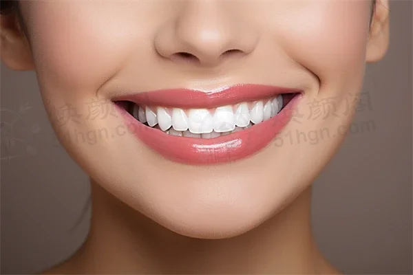 邯郸牙e生口腔服务怎么样？2026年最新客户反馈与真实体验分享