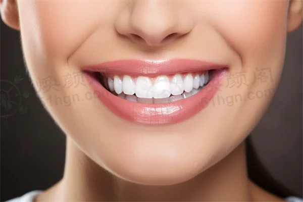 兰州地区牙科医院排名前十，哪家更胜一筹？兰州牙王国数字化口腔门诊部义齿项目活动火热进行中，品质杰出！