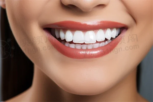 安徽芜湖江城口腔门诊部现推出限时优惠，烤瓷牙仅需1980元起，原价2800元起，机会难得，快来体验超值服务！