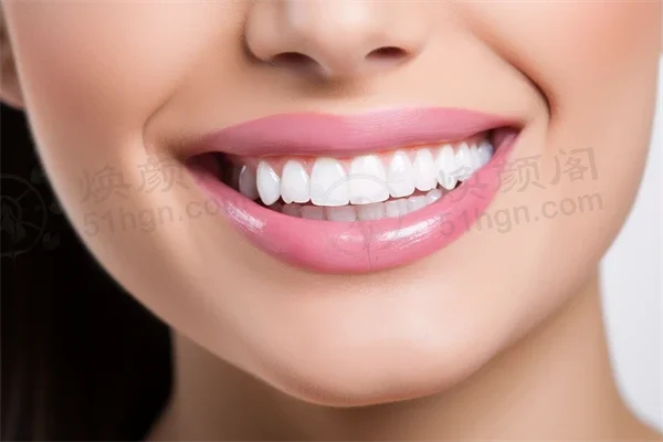 贵州都匀牙博仕口腔诊所牙套价格表：原价3888元起，现优惠仅需2999元起，轻松拥有迷人笑容！