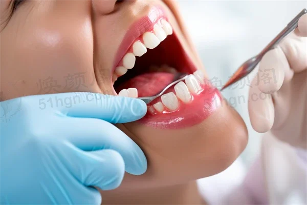 深圳牙科医院排名前十，哪家更值得信赖？深圳美奥口腔医院种植牙项目专業可靠，助您重拾自信笑容！