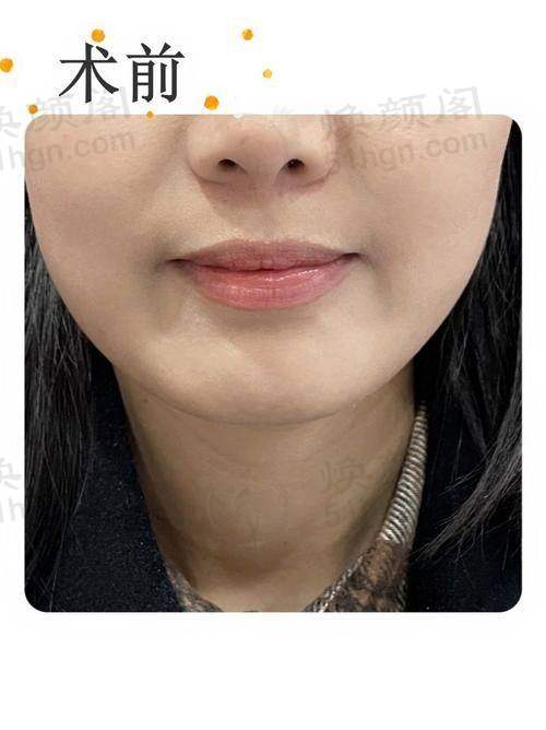 设备环境介绍