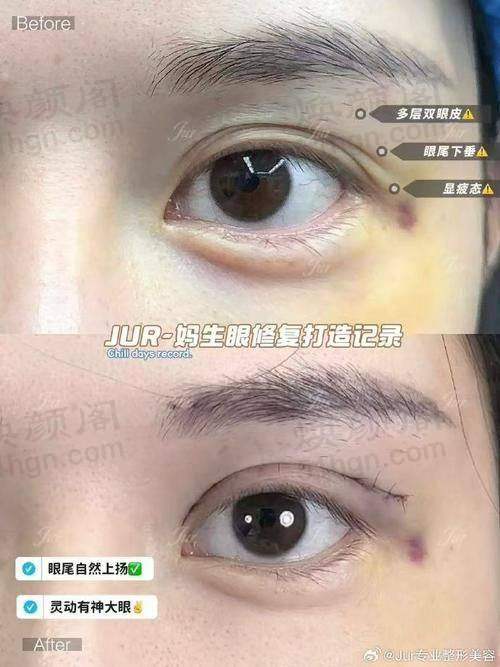 优惠活动详情