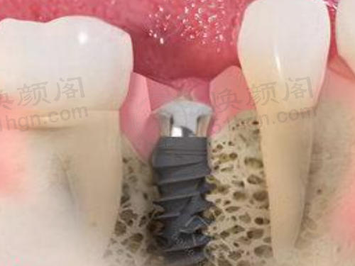 南充美昂口腔医院