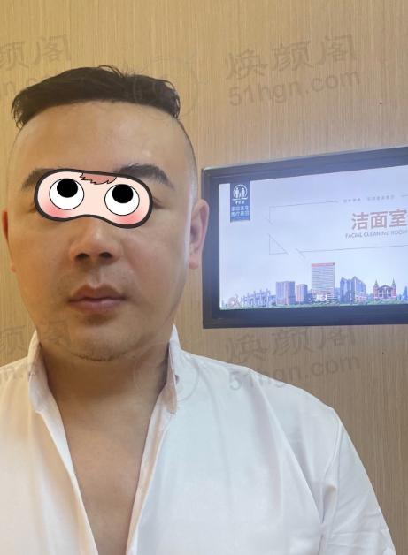 被色斑红血丝毛孔问题折磨多年，我靠中家医超光子重获美肌！ 