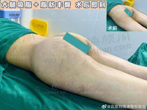 五、乔军 医生擅长项目有哪些