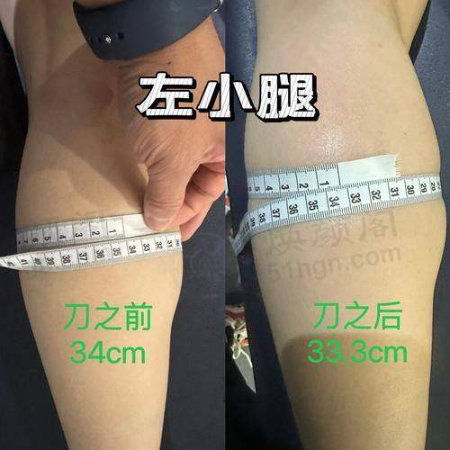 七、乔军 医生近期真实评价