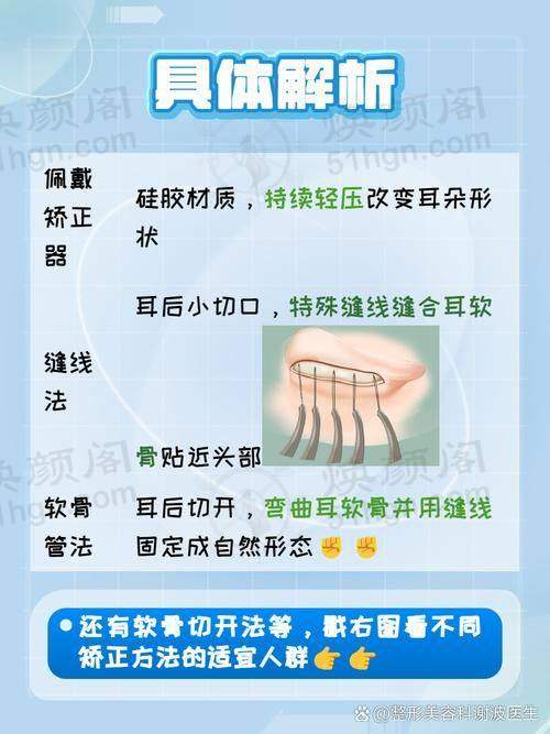 优惠活动详情