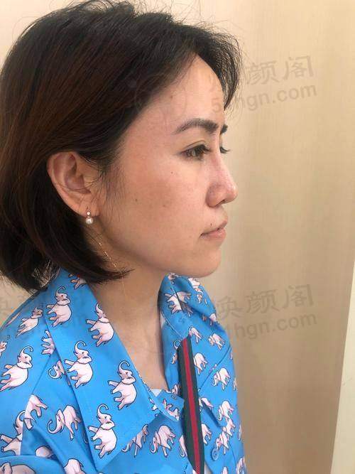 擅长项目详解