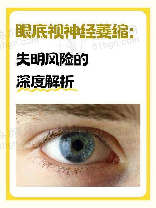 预约优惠活动 黑龙江中 医 药大学附属第一医院眼科王佳娣