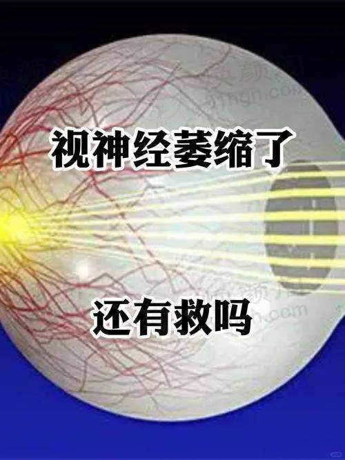 患者真实评价 黑龙江中 医 药大学附属第一医院眼科王佳娣