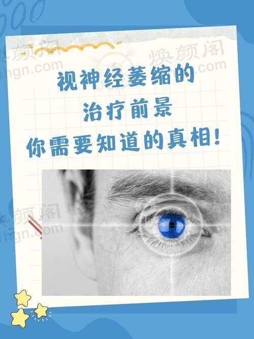 结尾预约号召 黑龙江中 医 药大学附属第一医院眼科王佳娣