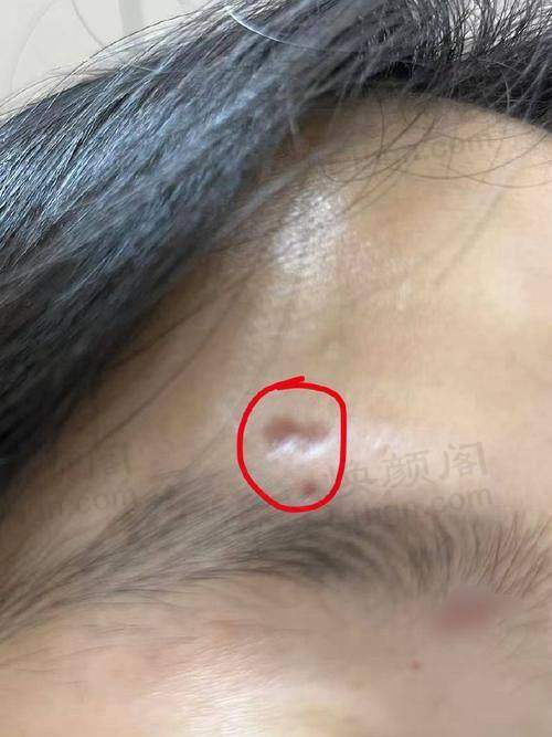 优惠活动详情