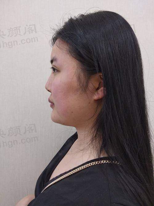 优惠活动详情