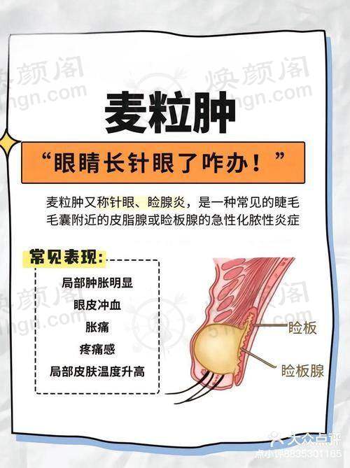 优惠活动详情