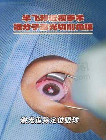 优惠活动详情
