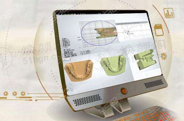 我在广州德伦口腔矫牙半年，从不敢露齿到自信绽放笑容！ 
