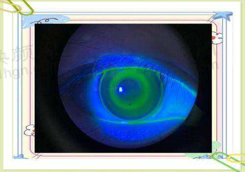 深圳市第二人民医院(眼科)